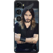 Чохол BoxFace Nubia Neo 5 GT 5G 
