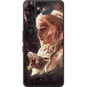Чохол BoxFace Nubia Neo 5 GT 5G 