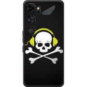 Чохол BoxFace Nubia Neo 5 GT 5G 