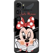 Прозорий чохол BoxFace Nubia Neo 5 GT 5G Lady M