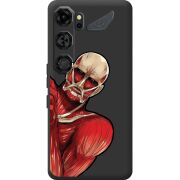 Прозорий чохол BoxFace Nubia Neo 5 GT 5G Титан