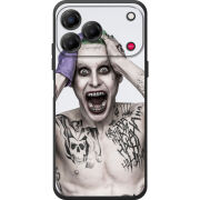 Чохол BoxFace Nubia V80 Design 