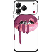 Чохол BoxFace Nubia V80 Design 
