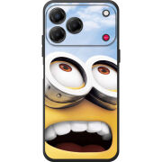 Чохол BoxFace Nubia V80 Design 