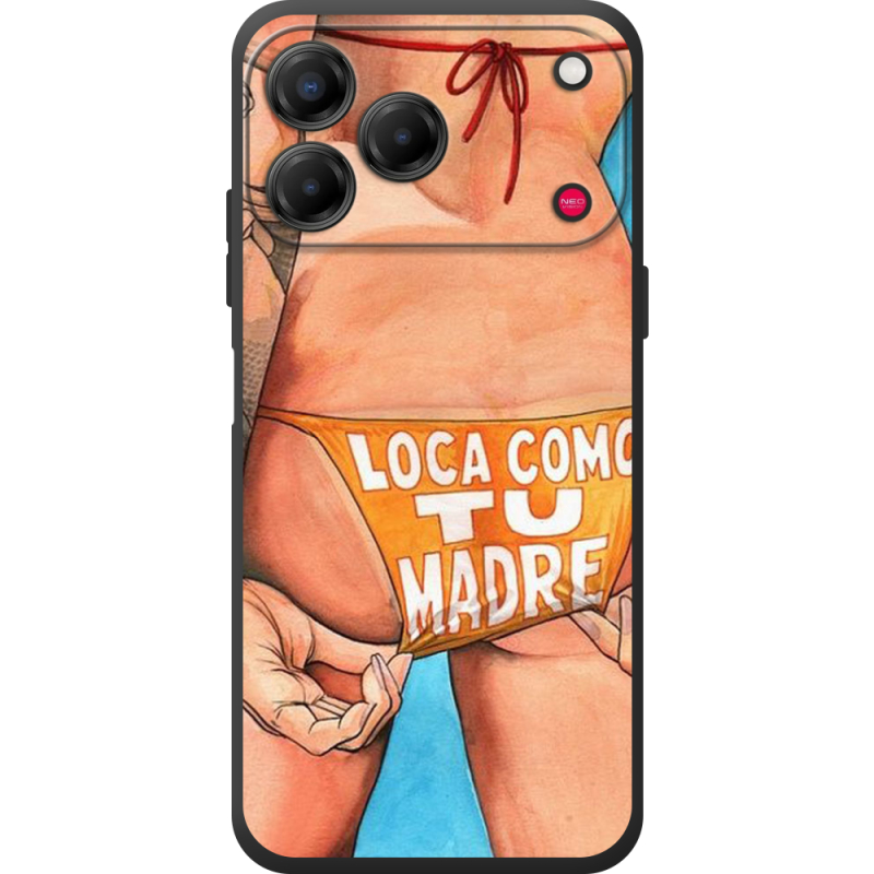 Чохол BoxFace Nubia V80 Design 