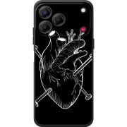 Чохол BoxFace Nubia V80 Design 