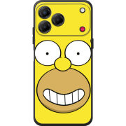 Чохол BoxFace Nubia V80 Design 