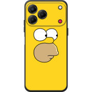 Чохол BoxFace Nubia V80 Design 