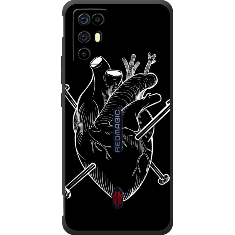 Чохол BoxFace Nubia RedMagic 6R 