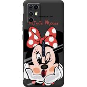 Прозорий чохол BoxFace Nubia RedMagic 6R Lady M