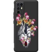 Чохол зі стразами Nubia RedMagic 6R Heart