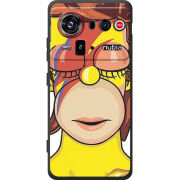 Чохол BoxFace Nubia Z80 Ultra 