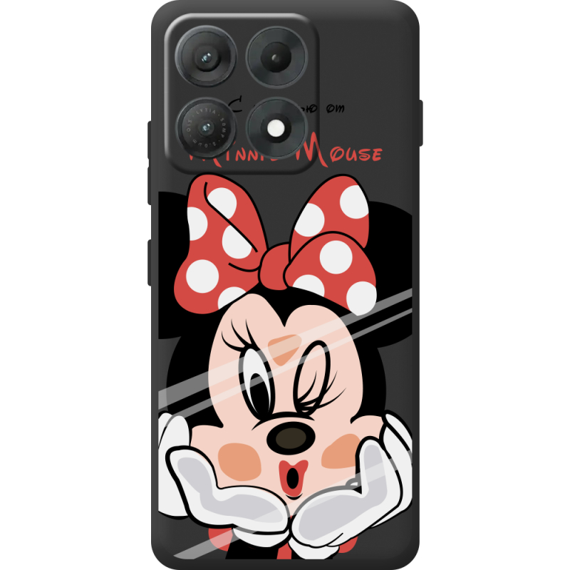 Прозорий чохол BoxFace Moto Edge 70 Max Lady M