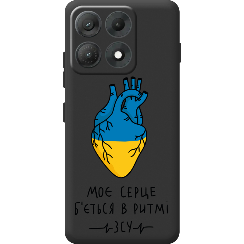 Прозорий чохол BoxFace Moto Edge 70 Max Моє серце в ритмі ЗСУ