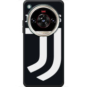 Чохол BoxFace Nubia Focus 2 Ultra FC J