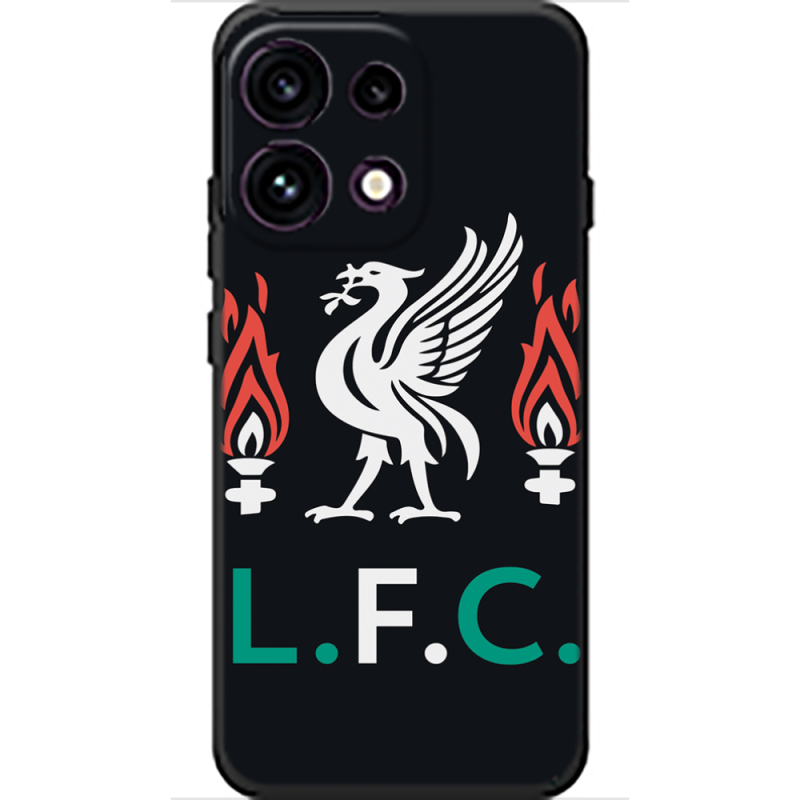 Чохол BoxFace OPPO Reno 16 Pro L. F. C.