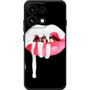 Чохол BoxFace OPPO Reno 16 Pro 