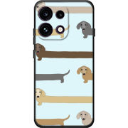 Чохол BoxFace OPPO Reno 16 Pro Dachshund