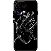 Чохол BoxFace OPPO Reno 16 Pro 