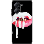 Чохол BoxFace Xiaomi Redmi A7 