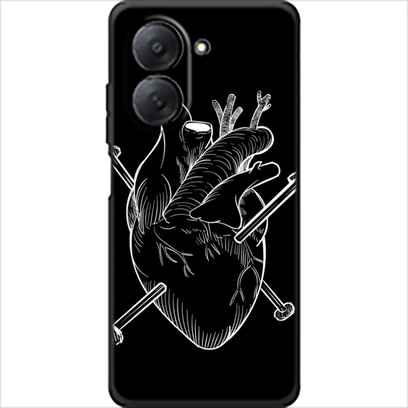 Чохол BoxFace Xiaomi Redmi A7 