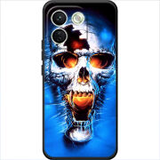 Чохол BoxFace Xiaomi Redmi Note 17 Pro Max 