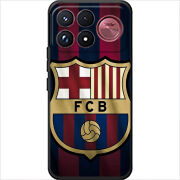 Чохол BoxFace Poco F9 Ultra 