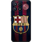 Чохол BoxFace Poco F9 Ultra 
