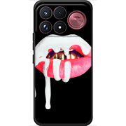 Чохол BoxFace Poco F9 Ultra 