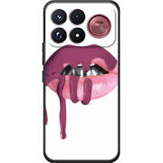 Чохол BoxFace Poco F9 Ultra 