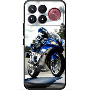 Чохол BoxFace Poco F9 Ultra 