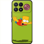 Чохол BoxFace Poco F9 Ultra 