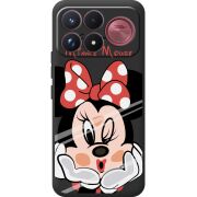 Прозорий чохол BoxFace Poco F9 Ultra Lady M