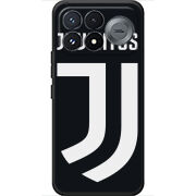 Чохол BoxFace Poco F9 Pro FC J
