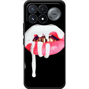 Чохол BoxFace Poco F9 Pro 