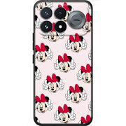Чохол BoxFace Poco F9 Pro 