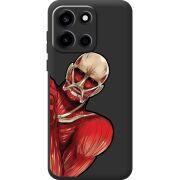 Прозорий чохол BoxFace OnePlus Nord 6 Титан