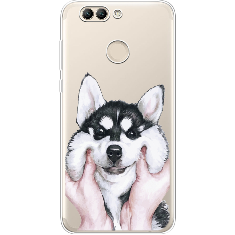 Прозрачный чехол Uprint Huawei Nova 2 Husky