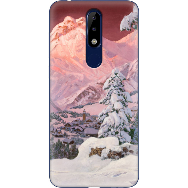 Чехол Uprint Nokia 5.1 Plus 